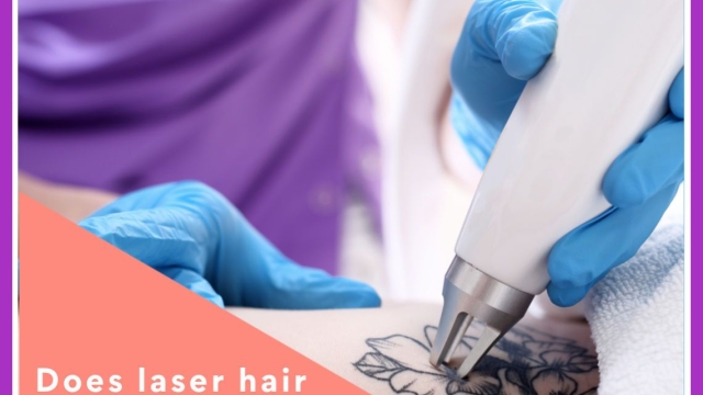 Tattoo Removal – Understand This Critical Info?