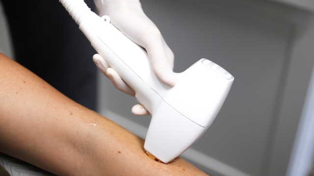 Say Goodbye to Unwanted Hair: Exploring the Magic of Laser Hair Removal!