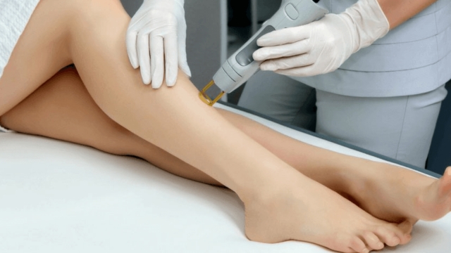 Unveiling the Science Behind Laser Hair Removal